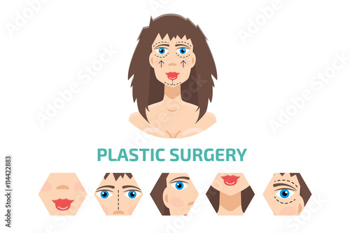 Plastic surgery infografic. Otoplasty, rhinoplasty