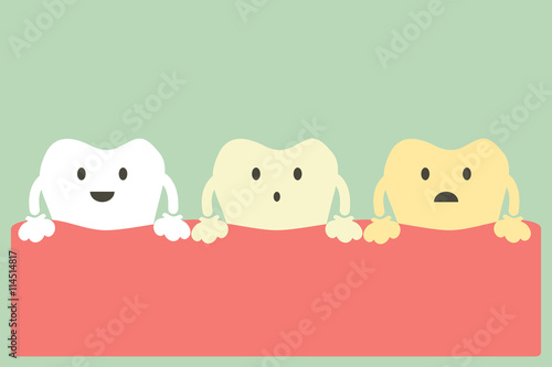 teeth whitening