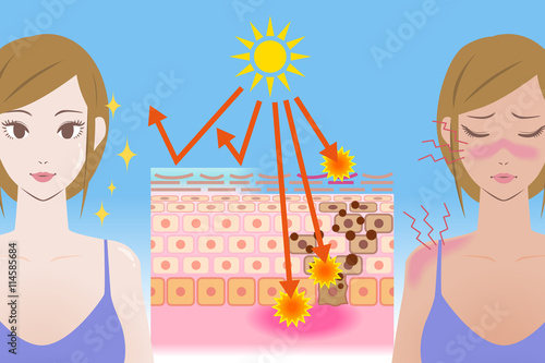 UV care before after image, young girl puts on the sunscreen or not, mechanism of the sunburn, vector illustration