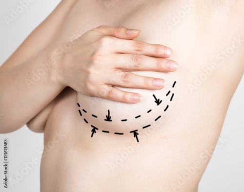 doctor makes dotted line on female body for cellulite correction. cosmetic surgery. lifting and breast augmentation