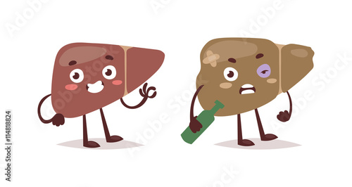 Alcoholic liver harm disease. Fatty liver fibrosis hepatitis cirrhosis of alcohol harm vector illustration. Lifestyle problem unhealthy alcohol harm can cause liver damage social cartoon concept.