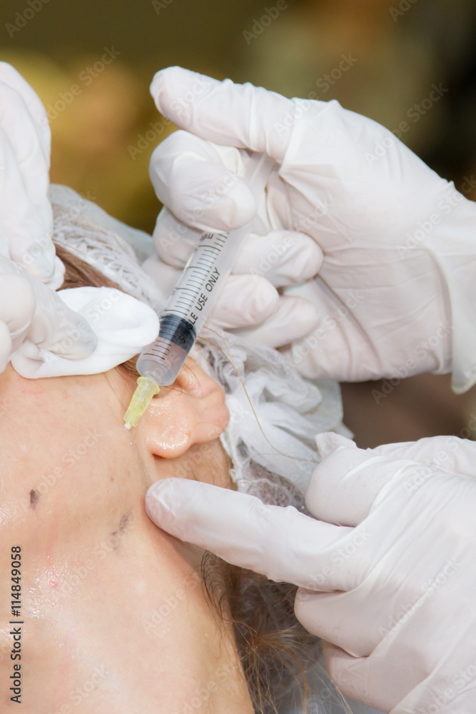 Fototapeta premium cosmetology, injection, plastic surgery face