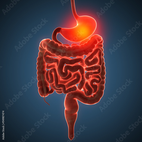 Disease illustration of human stomach