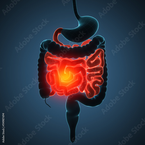 intestines disease illustration photo
