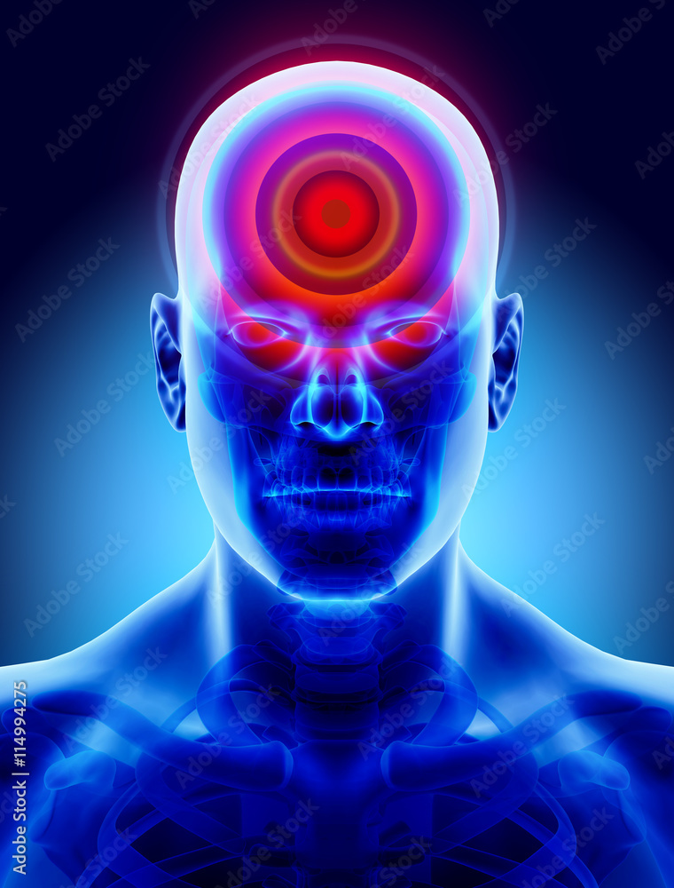 Head ache signal, medical concept. Head ache signal, medical concept.