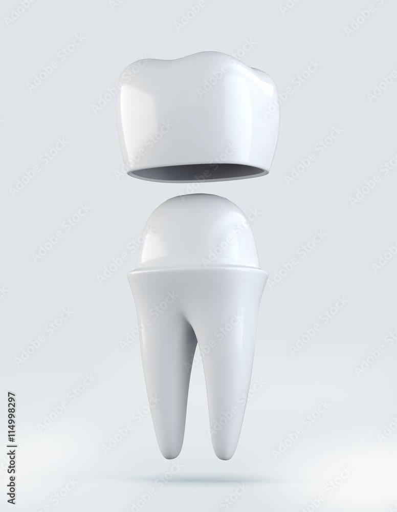 3D illustration of Crown tooth on white background. 3D illustration of Crown tooth on white background.