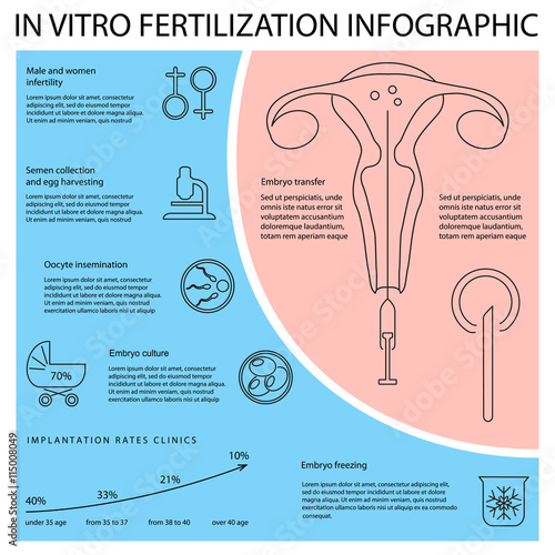 In vitro fertilization infographic. Illustration showing egg retrieval procedure, fertilization in laboratory, fertilized egg development and embryos transfer back to the uterus. Vector eps10