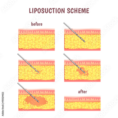 scheme of cosmetic surgery