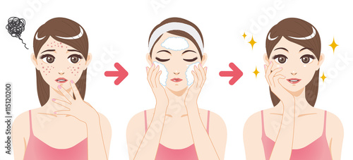 acne treatment before after, facial cleansing foam, cartoon illustration