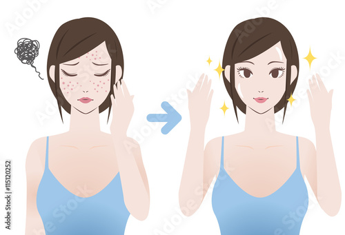 acne treatment before after image illustration