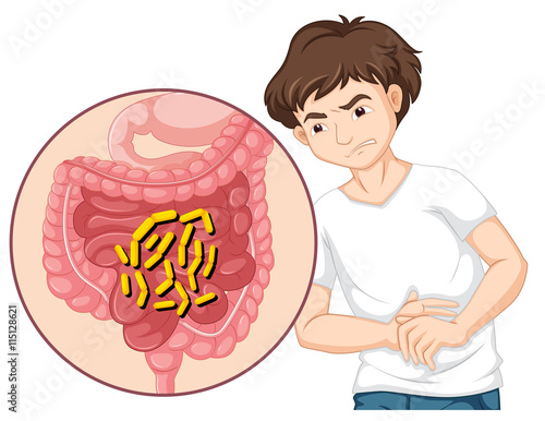Man having stomachache with bacteria