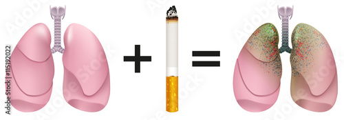 Healthy lungs plus cigarette result of lung cancer. Harm of smoking