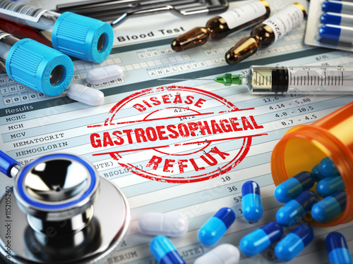Gastroesophageal reflux disease diagnosis. Stamp, stethoscope, s photo
