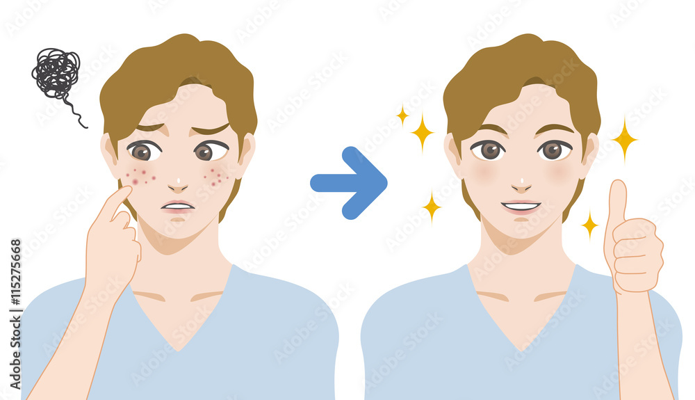young boy acne treatment before and after, facial cleansing foam, men's skin care, cartoon illustration