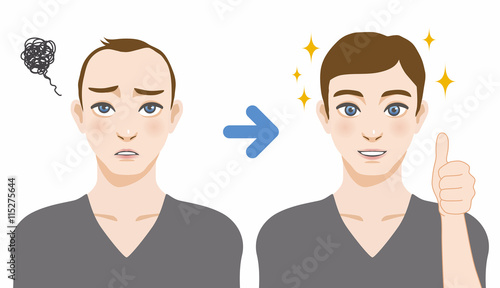 men's thinning hair treatment before after image illustration