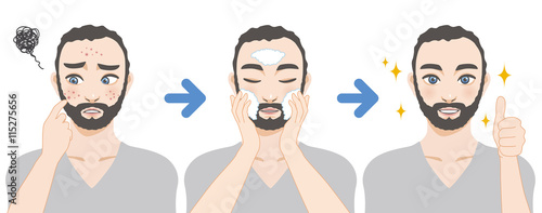 middle aged man acne treatment before and after, facial cleansing foam, men's skin care, cartoon illustration