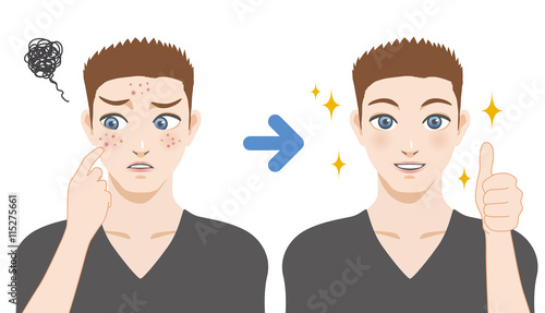 young boy acne treatment before and after, facial cleansing foam, men's skin care, cartoon illustration