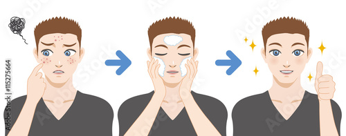 young boy acne treatment before and after, facial cleansing foam, men's skin care, cartoon illustration