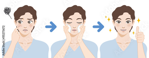 young boy acne treatment before and after, facial cleansing foam, men's skin care, cartoon illustration