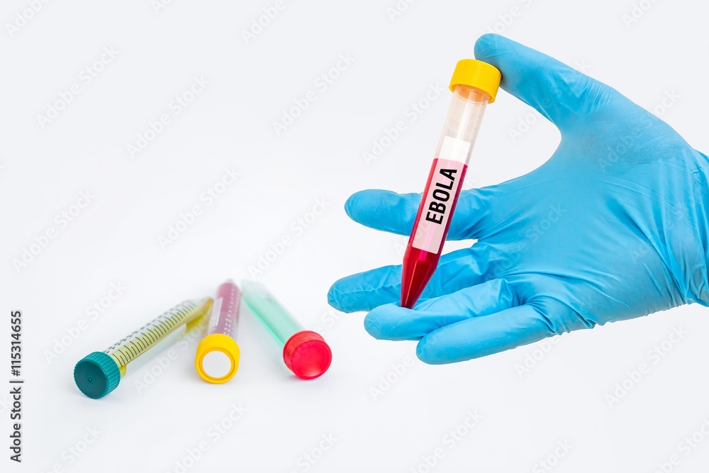 Naklejka premium Test-tube with blood sample for EBOLA test