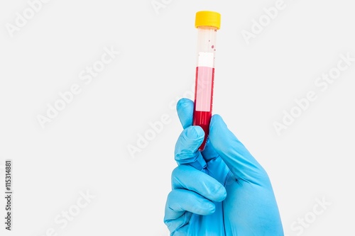 Test-tube with blood sample for blank label