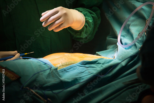 suture close sternotomy incision