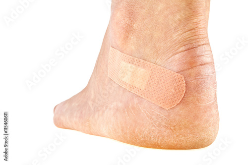 Closeup of woman's foot with adhesive plaster, Women's problems