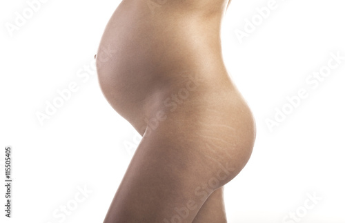 Pregnant woman with stretch marks on the buttocks