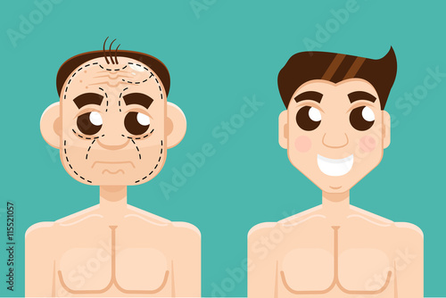 Plastic surgery man before and after