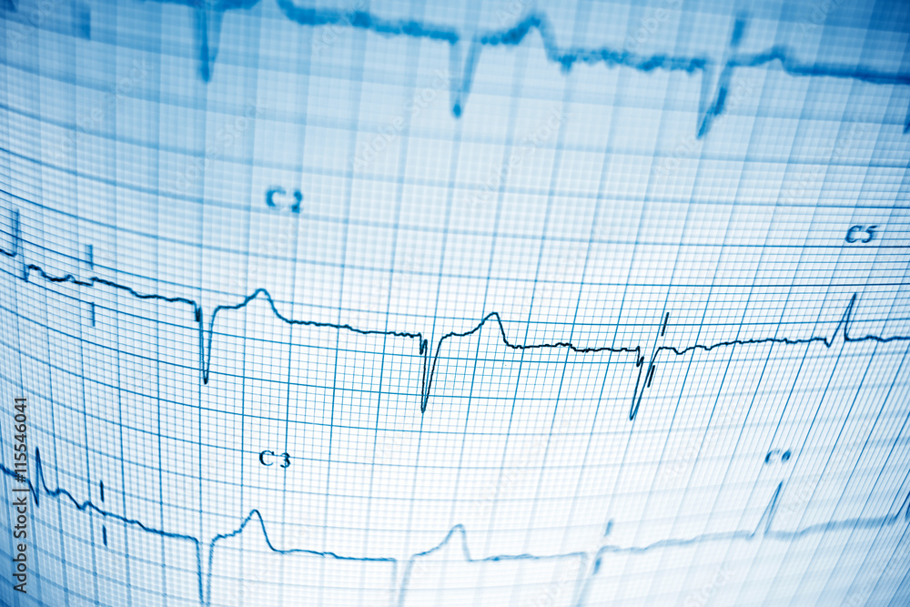 Naklejka premium Electrocardiogram
