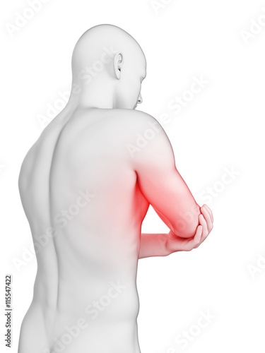3d rendered illustration of a painful elbow