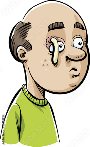 A cartoon man with a stye above his eye that has popped and is oozing pus.
