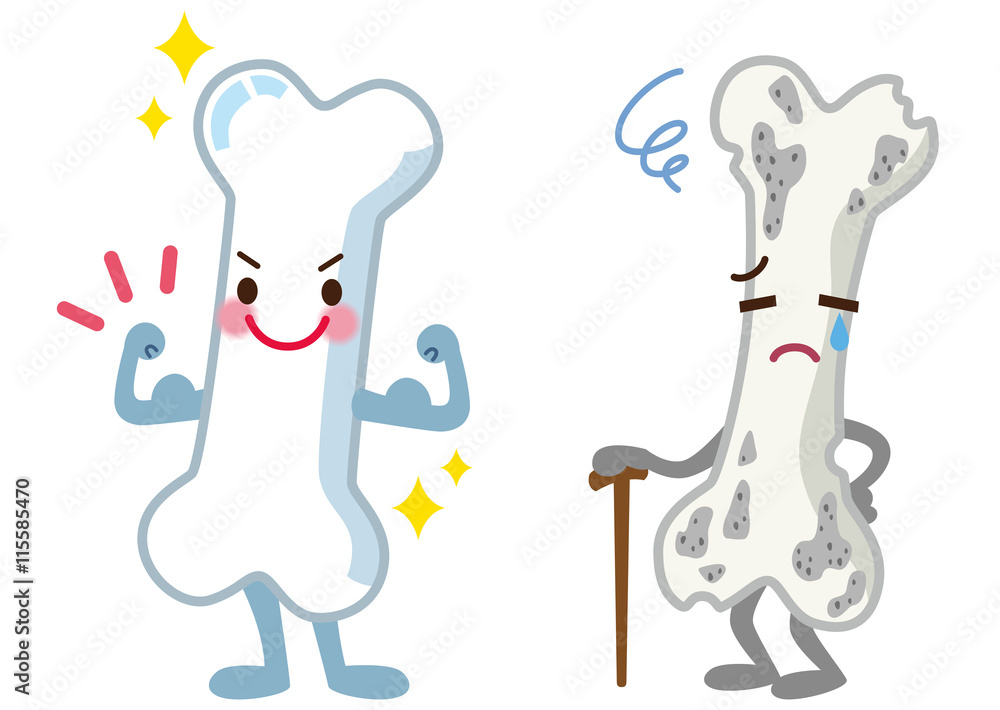 丈夫な骨 弱い骨 医療 Stock イラスト Adobe Stock