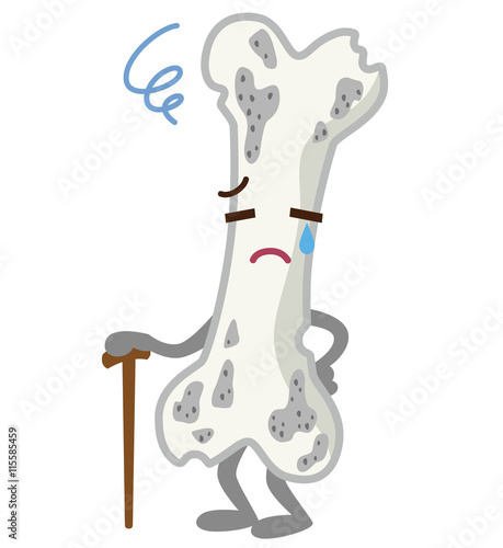 不健康な骨　医療