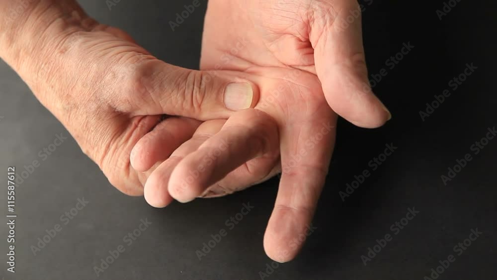 Man has painful joints on his hand, copy space included Man has painful joints on his hand, copy space included