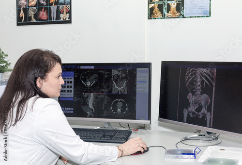 Brunette female doctor examining an CT scanner results