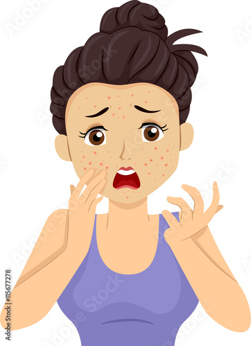 Teen Girl Pimple Breakout