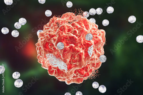 Destruction of a tumor cell by nanoparticles. 3D illustration. Can be used also to illustrate effect of drugs, medicines, microbes