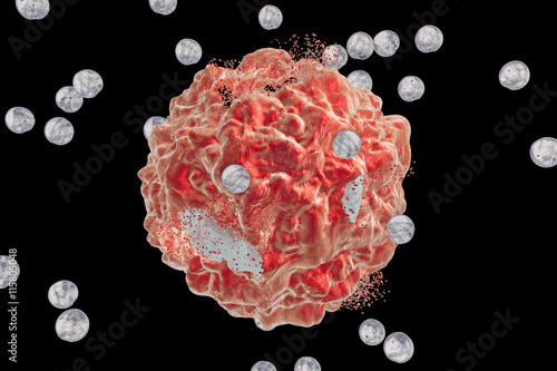 Destruction of a tumor cell by nanoparticles. 3D illustration. Can be used also to illustrate effect of drugs, medicines, microbes