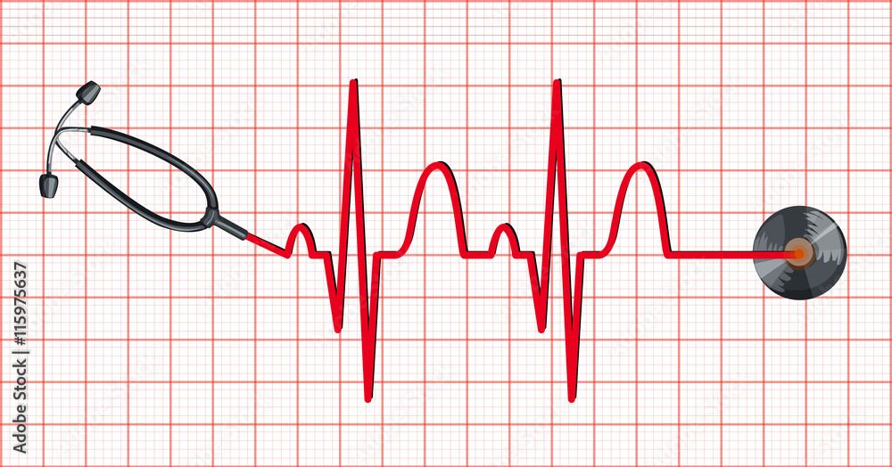 Stethoscope and heartbeats on graph paper