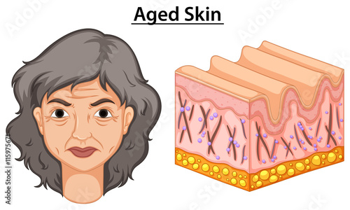 Diagram showing woman with aged skin