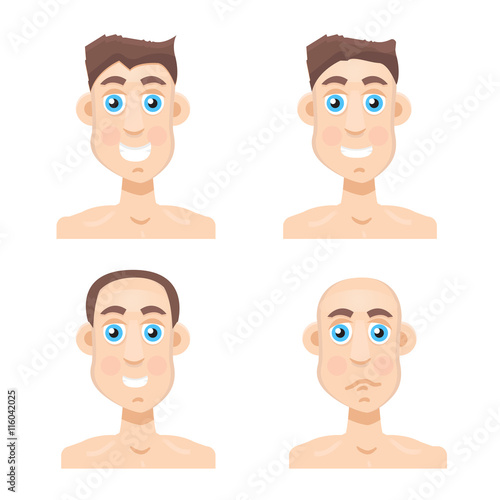 Stages Of Hair Loss new before and after