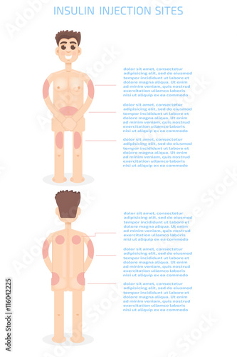 Injection sites infographics