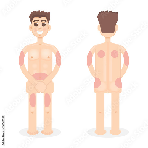Insulin injection sites