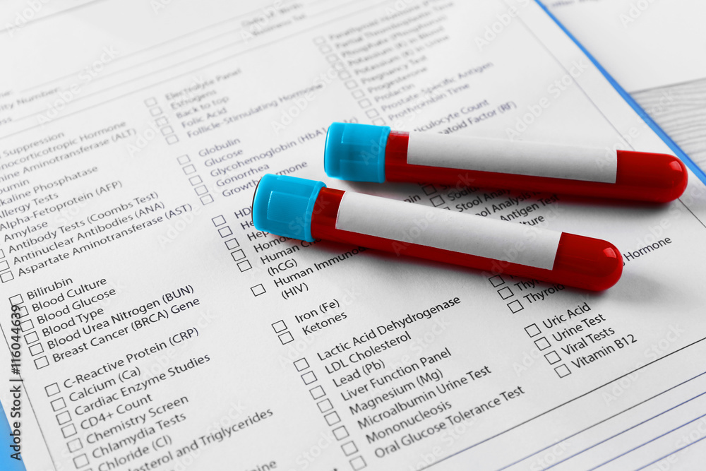 Fototapeta premium Blood test. Health care concept
