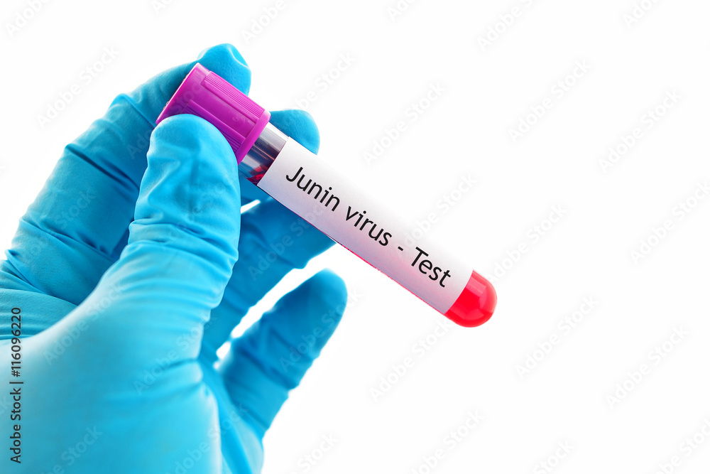 Obraz premium Blood sample for Junin virus test, diagnosis for South American hemorrhagic fevers 