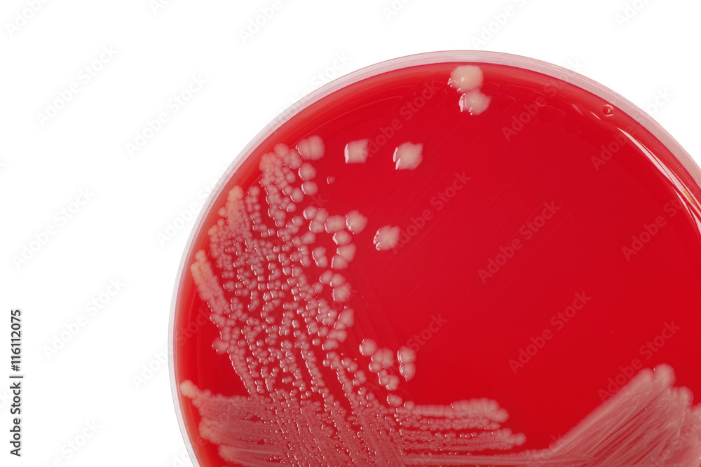 Salmonella enteritidis bacterial colonies on blood agar plate, m foto