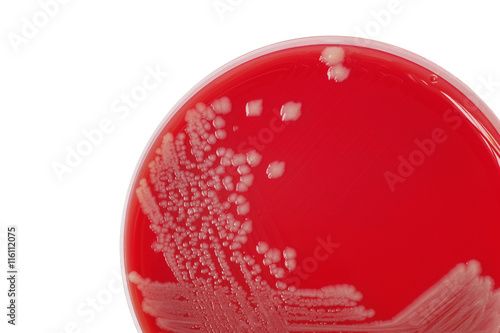 Fotótapéta Salmonella enteritidis bacterial colonies on blood agar plate, m