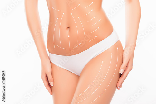 Close up photo of woman's belly and hip with drawing arrows on i photo