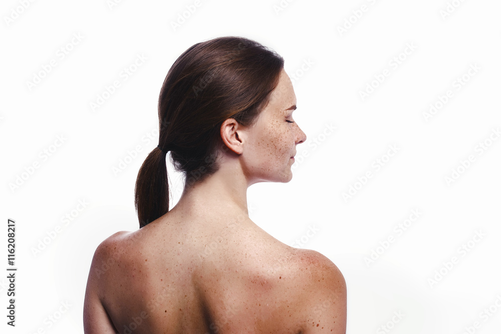 freckles freckles